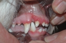 Hochgradig rot und blutendes Zahnfleisch